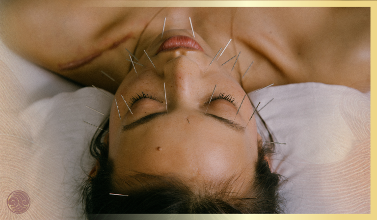 קארינה עם מחטים 768