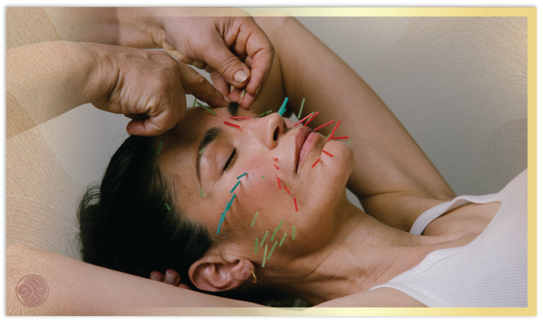 תמונה לירז עם מחטים-02 768