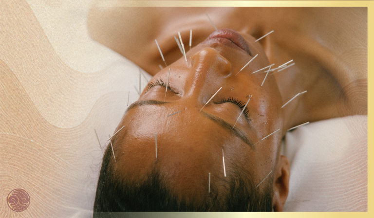 תמר עם מחטים 768